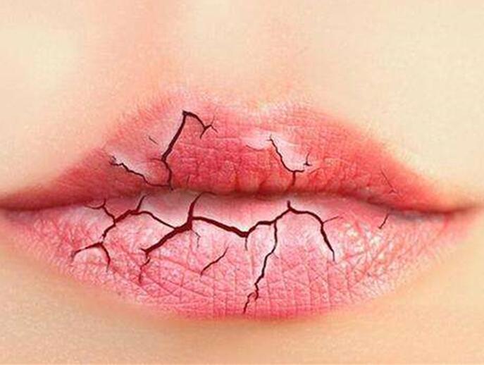 6個美容技巧，解決秋季嘴唇干燥