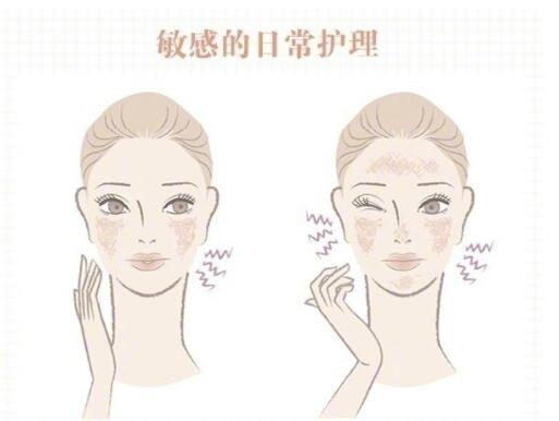 敏感肌保養(yǎng)大全！