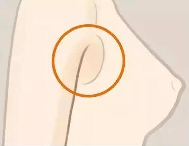 減副乳，瘦手臂一招就解決！