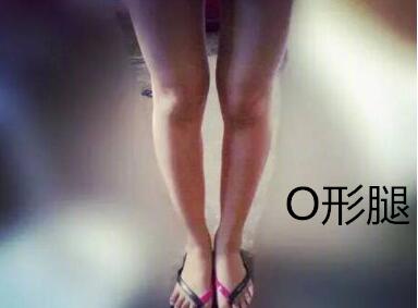 糾正你的腿型！