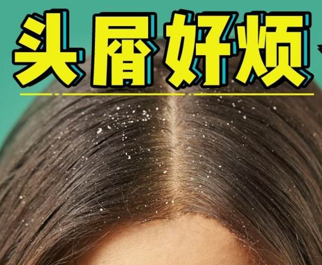 南寧正規(guī)美發(fā)培訓(xùn)學(xué)校分享：冬天如何減少頭屑過多？