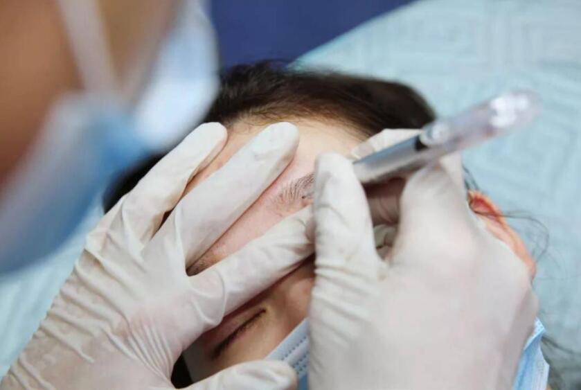 紋繡遇到容易出血的皮膚怎么辦？南寧專業(yè)紋繡培訓(xùn)教你