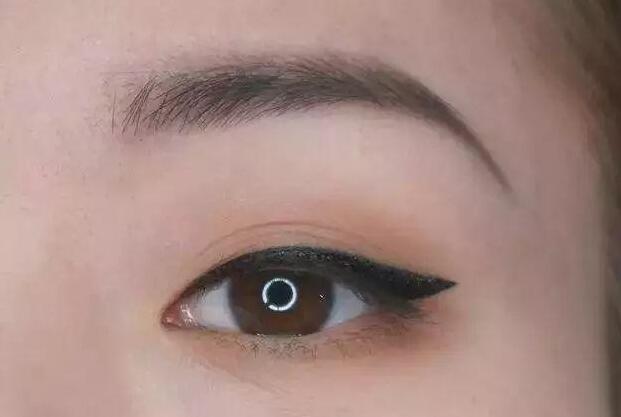 眼尾三角區(qū)怎么處理？