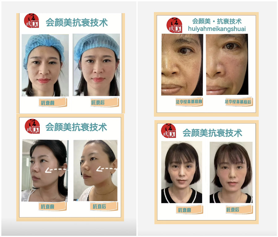 1670404966957017.jpg 101.jpg