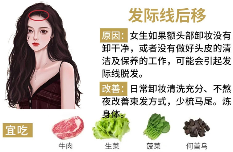 如何改善掉頭發(fā)？南寧頭療養(yǎng)發(fā)護發(fā)教學