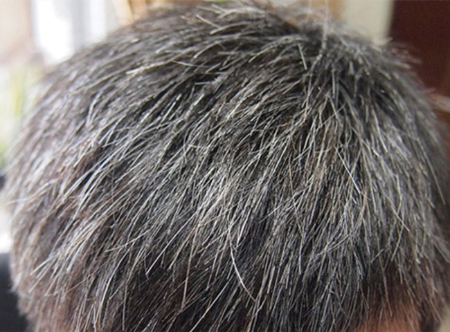 南寧美發(fā)基礎(chǔ)教學(xué)：為什么會長白頭發(fā)？